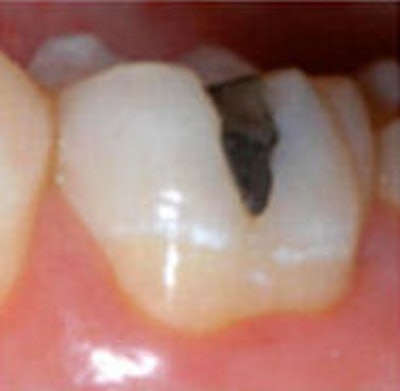 2009 04 07 10 26 29 744 2009 04 07 4yearsb