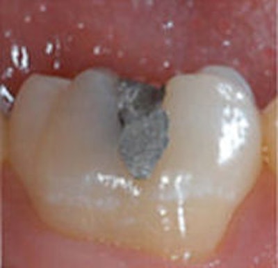 2009 04 07 10 26 29 849 2009 04 07 Repairb