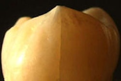 2009 04 20 09 44 03 404 2009 04 20 Toothcracks