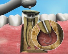 2009 04 24 11 39 57 289 2009 04 23 Apexum