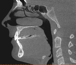 2009 04 27 13 59 21 825 2009 04 28 Cbct1