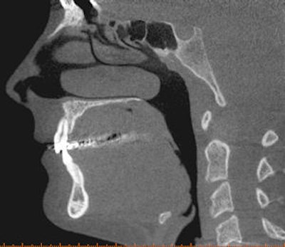 2009 04 27 13 59 21 825 2009 04 28 Cbct1