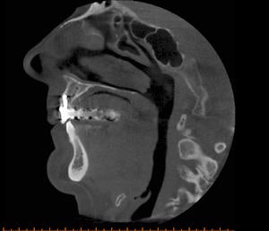 2009 04 27 13 59 23 671 2009 04 28 Cbct2