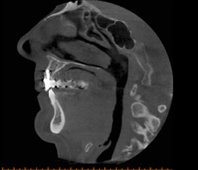 2009 04 27 13 59 23 671 2009 04 28 Cbct2