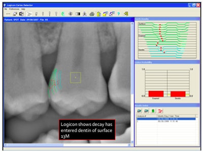 2009 05 01 14 22 54 404 2009 05 04 Drsoftware2