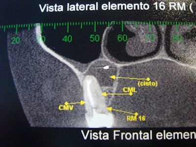 2009 06 19 16 17 55 882 2009 06 18 Lateral Cbct
