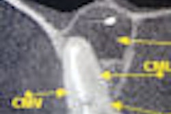 2009 06 19 16 19 14 582 2009 06 18 Lateral Cbct Thumb2