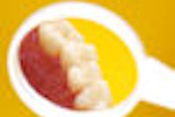 2009 05 07 09 42 13 153 Teeth Mirror 70