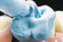 2009 07 14 14 18 27 349 2009 07 15 Crown Thumb