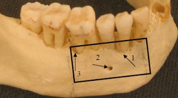 2009 07 27 16 04 36 631 2009 07 28 Us Jawbone