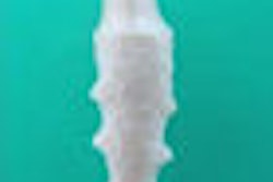 2009 08 07 13 47 51 754 2009 08 10 Zirconia Implant Thumb