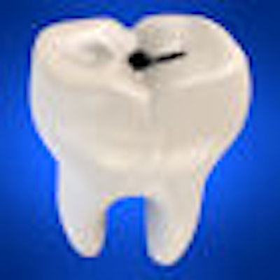 2009 05 06 09 41 49 364 Tooth Caries 70