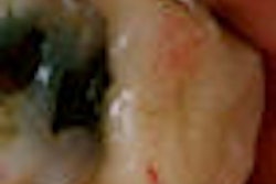 2009 09 04 14 46 39 358 2009 09 08 Articulating Paper Thumb