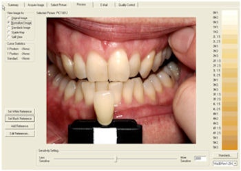 2009 09 10 16 17 23 904 Clarity Dental Clear Match 350