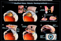2009 09 17 09 51 31 683 Mookp Thumb