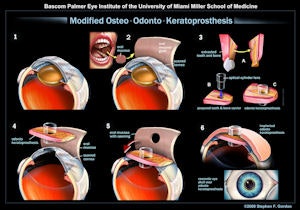 2009 09 17 09 51 31 683 Mookp Thumb