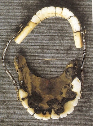 2009 10 20 17 21 40 483 Jimmyearll3 300