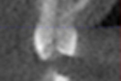 2009 10 29 11 25 47 663 Conebeamthumbnail 70