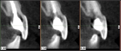 2009 10 29 11 25 49 245 Conebeamfig1 400