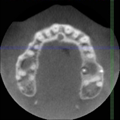 2009 10 29 11 25 51 134 Conebeamfig2 250