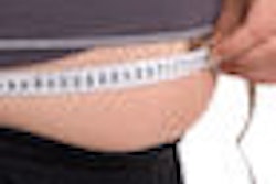 2009 11 03 11 05 21 606 Obesity 70