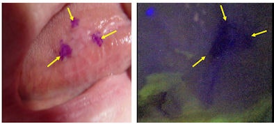 2009 11 19 11 01 01 432 Autofluorescence 394