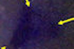 2009 11 19 11 13 40 691 Autofluorescence Thumb