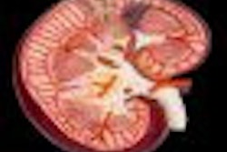 2009 12 04 12 01 58 750 Kidney 70
