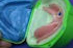 2009 12 10 16 09 31 466 Denture Tray 70