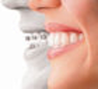 The Dos and Dont's Of Invisalign