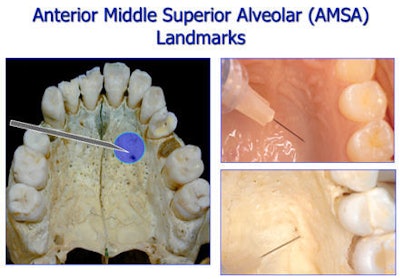 2010 02 16 13 20 34 760 2010 02 16 Sta3b Amsa