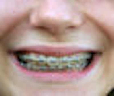 2008 12 05 15 46 27 330 Orthodontics 70