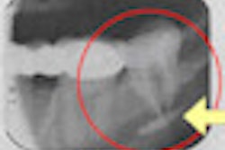 2010 02 02 12 41 18 604 Sargenti 70