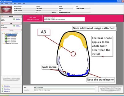 2010 03 08 18 19 02 476 Vident Shade Assist 400