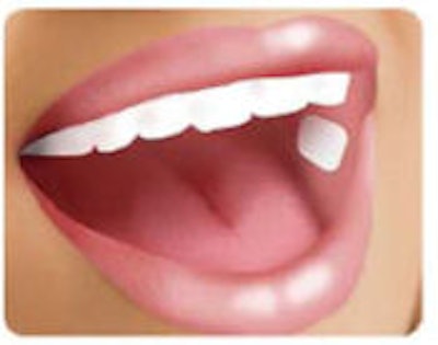 2010 03 09 14 54 44 908 Bio Delivery Sciences Bema