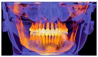 2010 03 11 18 26 38 394 2010 03 12 Gendex