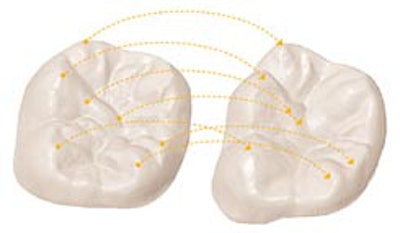 2010 03 11 18 26 41 613 2010 03 12 Cerec