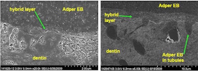 2010 03 17 10 04 29 412 2010 03 17 Etch