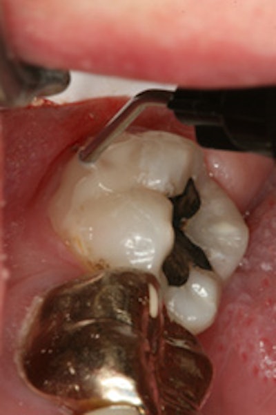 2010 03 25 16 54 33 172 Pentron Fusio7 175