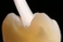 2010 03 25 16 54 36 734 2010 03 26 Vertise Thumb