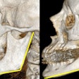 2010 03 26 13 49 17 700 2010 03 26 Ct Aging