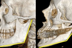 2010 03 26 13 49 17 700 2010 03 26 Ct Aging