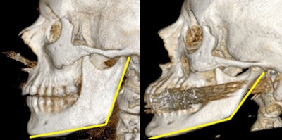 2010 03 26 13 49 17 700 2010 03 26 Ct Aging