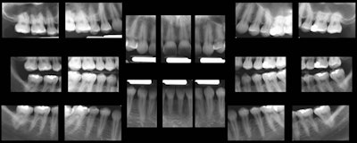 2010 03 30 10 15 14 93 2010 03 30 Tomofig6 Lg