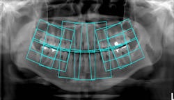 2010 03 30 10 15 27 423 2010 03 30 Tomofig4 Sm