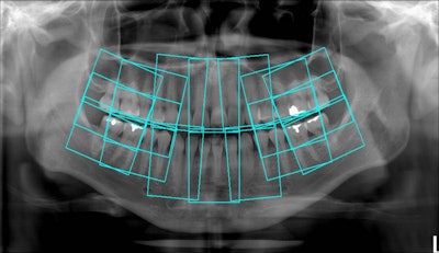 2010 03 30 10 15 34 167 2010 03 30 Tomofig4 Lg