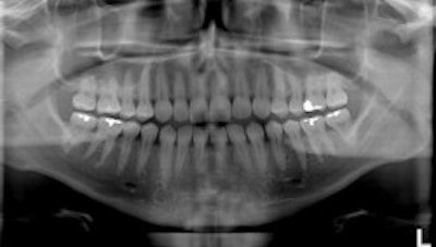 2010 03 30 10 15 37 279 2010 03 30 Tomofig3 Sm