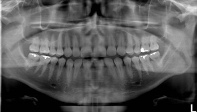 2010 03 30 10 15 47 229 2010 03 30 Tomofig2 Lg