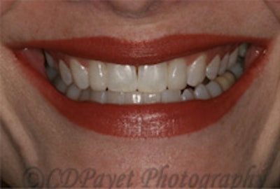 2010 04 22 13 53 54 380 2010 04 30 Canon Eos3