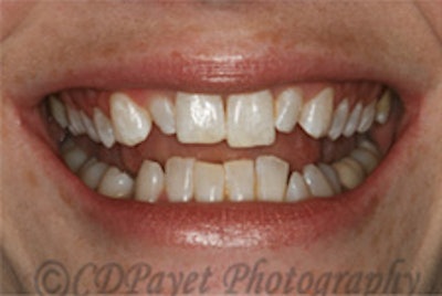 2010 04 22 13 53 57 840 2010 04 30 Canon Eos2